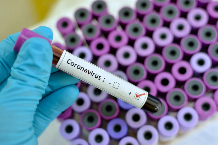 Coronavirus : L'Algérie recense 469 nouveaux cas et 9 décès en 24 h