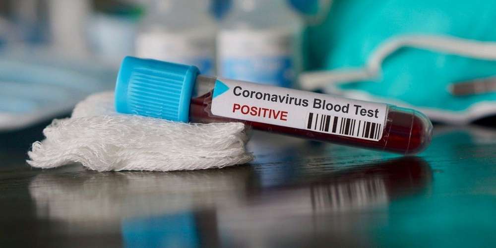 Coronavirus: 395 nouveaux cas, 230 guérisons et 5 décès